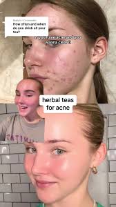 Kenny 24 Before Herbalife