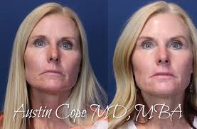 Cope Cosmetic Dermatology