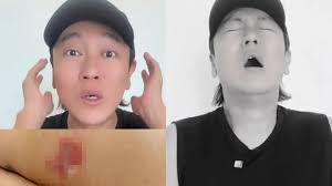 没穿衣睡觉被隐翅虫“袭击”，本地艺人#赖宇涵皮肤发烂流脓，伤势触目惊心！ 完整报道>>https://8wvib.es/4aF9g7U