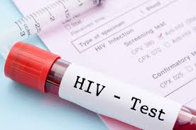 Hiv Test Types Procedure Importance And Results Dr Lal Pathlabs