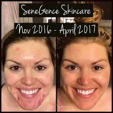 I went out and got some! It is EVERYTHING.