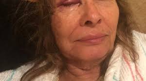 Fundraiser by Alba Guevara : Luchando por sobrevivir trying to survive