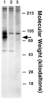Expression and Function of the Human Granulocyte-Macrophage  Colony-Stimulating Factor Receptor α Subunit