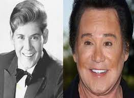 Wayne newton is a singer of both country mix and classic rock who was born in. Botched Plastic Surgery Wayne Newton Plastic Surgery Before And After Facelift Eyelid Plastic Surgery Wayne Newton Plastic Surgery Celebrity Plastic Surgery