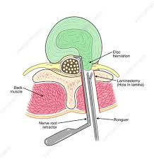 Check spelling or type a new query. Labeled Back Muscles Keyword Search Science Photo Library