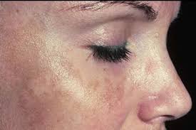 La tulipe milk cleanser adalah merk sabun muka untuk kulit kering dalam bentuk susu pembersih muka yang sebetulnya dibuat untuk kulit normal. 6 Punca Kulit Kering Yang Anda Perlu Tahu Nurraysa