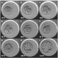 Time Lapse Imaging Of Embryo Development Using Morphokinetic Analysis To Select Viable Embryos Chapter 16 Culture Media Solutions And Systems In Human Art This will break down timing data into another view: time lapse imaging of embryo