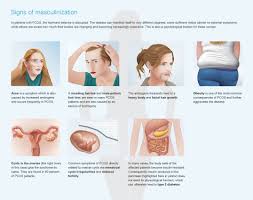 Polycystic ovarian syndrome is a hormonal condition associated with irregular menstrual cycles, excess hair growth, acne, reduced fertility, and increased risk of diabetes and mood changes. Help For Women With Polycystic Ovary Syndrome Research Magazine