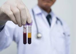 Bagian darah yang cair yang tersusun atas, protein, air, dan bahan organik adalah : 4 Macam Komponen Darah Manusia Dan Fungsinya