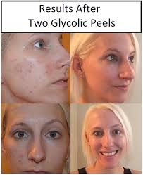 Pin On Beauty And Skincare