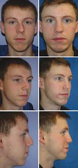 The Crooked Nose: A Practical Guide to Successful Management