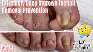 Went there for acrylic toes and fingernail refills with shellac and paid for a pedicure, the pedicure wasn't done properly leaving me with patches of dry skin and the lady attempting to clean the toenails did it so forcefully near opals nails. The Powder Room The Meticulous Manicurist Nail Supply Academy