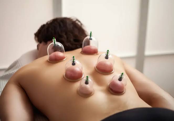 Dry cupping and wet cupping hijama in Dubai