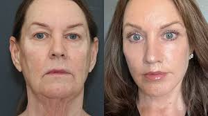 Η viral μεταμόρφωση αυτής της 66χρονης γυναίκας έχει αφήσει τους πάντες με  το στόμα ανοιχτό