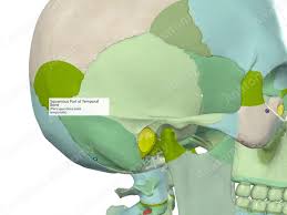 Image result for Temporal Bone