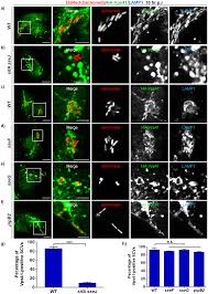 Salmonella infection (salmonellosis) is a common bacterial disease that affects the intestinal tract. Salmonella Exploits The Host Endolysosomal Tethering Factor Hops Complex To Promote Its Intravacuolar Replication