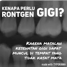 Kenapa Perlu Rontgen Gigi Rontgen Gigi Diperlukan Untuk Melihat Yang Gak Terlihat Langsung Oleh Mata Bukan Maksudnya Bukan K Gigi Kesehatan Gigi Instagram