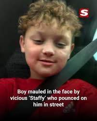 I ran across the road and he was sat there. I remember seeing his massive  facial injuries."