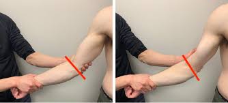 Image result for Elbow Extension Test