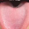 If you're experiencing one or more of these symptoms, you should discuss them with your doctor in order to identify the cause and receive the correct. Https Encrypted Tbn0 Gstatic Com Images Q Tbn And9gcsdlznl9vybeoyyniix1gkstsv9nk2wwtbpkxwmloe Usqp Cau