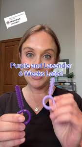 Light Violet Braces Color