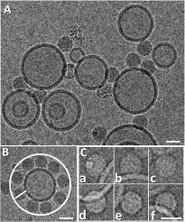 This is a most commonly occurring viral infection, affecting people. Human Rhinovirus Subviral A Particle Binds To Lipid Membranes Over A Twofold Axis Of Icosahedral Symmetry Journal Of Virology