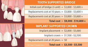 Maybe you would like to learn more about one of these? What Is The Average Cost For Dental Implants Dental News Network