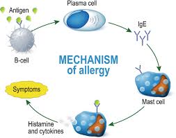 Image result for Exercise-Induced Anaphylaxis