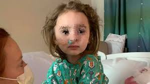 Frida bollani è la figlia di stefano bollani e della sua collega petra magoni. Jade 4 Anni Diventa Cieca Per Colpa Dell Influenza I Genitori Vaccinate I Vostri Figli
