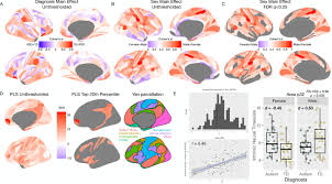 English news lesson on lie detector tests: Intrinsic Excitation Inhibition Imbalance Affects Medial Prefrontal Cortex Differently In Autistic Men Versus Women Elife