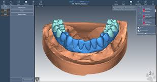 Cad Lynx Evolution 🦾💪🦷:  https://www.88dent.com/software/software-cad/cad-lynx-evolution.html