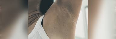This article is for the inner fashion enthusiast in you who would finally breathe a sigh of relief! Eating To Lighten Your Underarms Recipe By Shonali Sabherwal