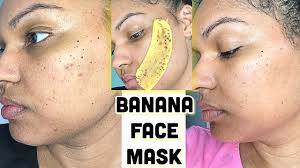I Rubbed Banana Peel On My Face My Pimples Acne Scars Are Gone 5 Day Banana Face Mask Youtube Great news!!!you're in the right place for banana peel. i rubbed banana peel on my face my pimples acne scars are gone 5 day banana face mask