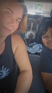 Melanoma removal and healing experience