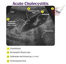 Image result for Murphy Sign