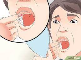 Sometimes, the signs of wisdom teeth growing in can be more subtle, as is the case with headaches. How To Tell If Your Wisdom Teeth Are Coming In 9 Steps