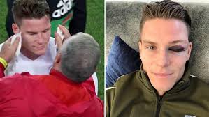 Miguel gameiro (born 1974), portuguese singer and chef. Laliga Santander Valencia Gameiro Shows Off His Black Eye After Clash With Pique Marca In English