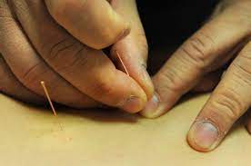 4 r carmes, 43000 le puy en velay voir le plan. Un Praticien Condamne Pour Exercice Illegal De La Medecine Le Puy En Velay 43000