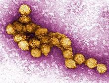 Jun 12, 2021 · wieder ein virus auf dem vormarsch. West Nile Virus Wikipedia