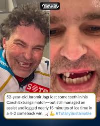 Jaromir Jagr is a living legend! 😂🦷