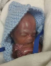 Luke Parrish Obituary