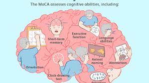 R1, clock face drawing component; Montreal Cognitive Assessment Moca Test For Dementia