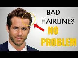 5 Awesome Hairstyles For Widows Peak Receding Hairline Hairstyles For Receding Hairline Widow S Peak Widows Peak Hairstyles