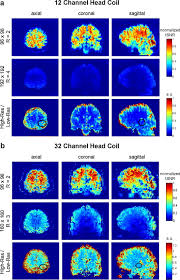 Check spelling or type a new query. Optimized Protocol For High Resolution Functional Magnetic Resonance Imaging At 3 T Using Single Shot Echo Planar Imaging Sciencedirect