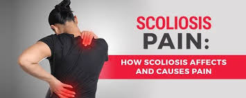 Costochondritis refers to the inflammation of the cartilage which connects your ribs to your breastbone. Scoliosis Pain How Scoliosis Affects And Causes Pain