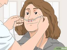 Nasal prongs should not completely occupy the nares. 3 Ways To Insert A Nasal Cannula Wikihow