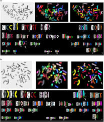 Oxford international english schools has uk centres in brighton, greenwich and oxford. Chromosomal Rearrangements After Ex Vivo Epstein Barr Virus Ebv Infection Of Human B Cells Oncogene