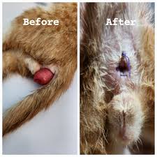 Image result for Rectal prolapse