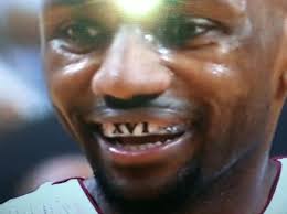 Photo: LeBron James' Mouthpiece Contains a Championship Message