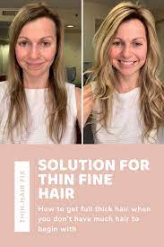 Fphl runs in families and affects some women more than others, says ruggiero. Pin On Fine Hair